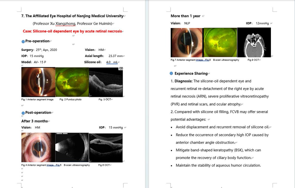🍁 Case7：To save eyeball for the patient with acute retinal necrosis (#ARN), severe proliferative vitreoretinopathy (#PVR) and retinal scars, and ocular atrophy.#ophthalmologist #retina #ocularprosthesis #oculartrauma