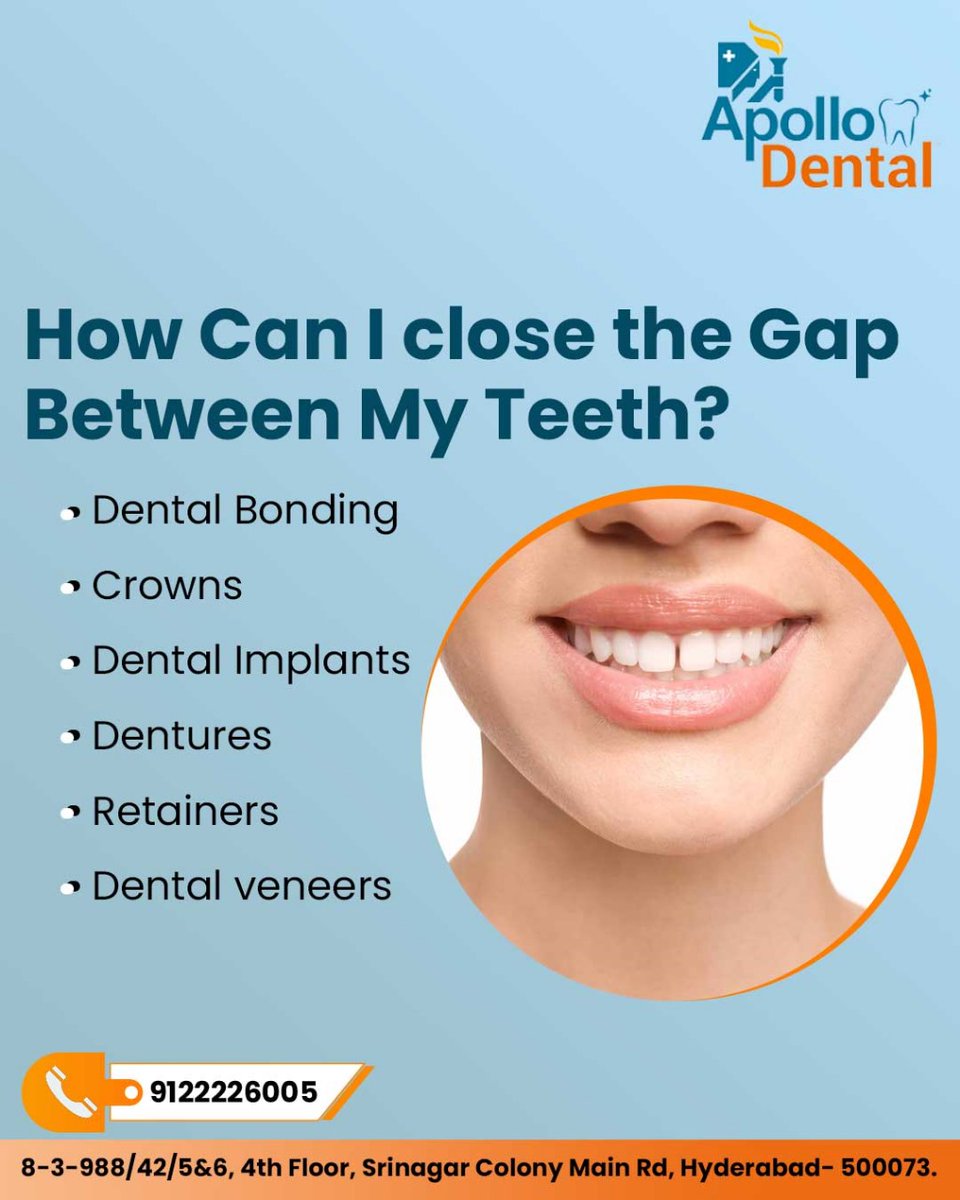 DentalApol94103's tweet image. How Can I Close the Gap Between My Teeth?
A new chapter in your smile story: exploring tooth gap solutions.
Book Your Appointment Now
Call: 9122226005

#teethgap #apollodentalclinic #srinagarcolony #ToothGap #SmileTransformation #GapClosure #Orthodontics #DentalOptions