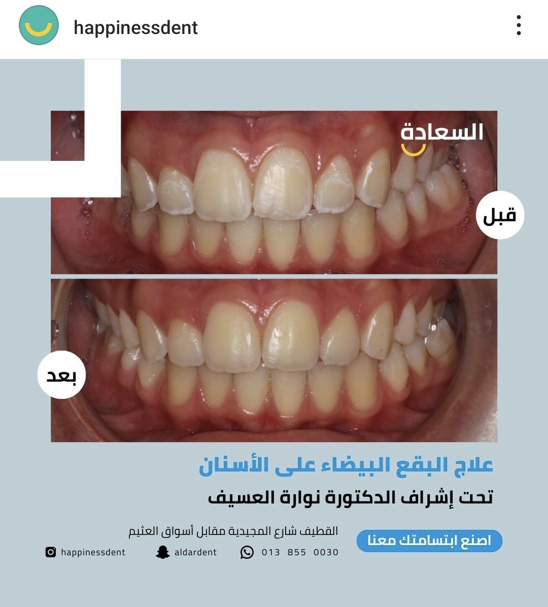 JQurain's tweet photo. @ask_alshargiy https://t.co/NhAkMzzk9i