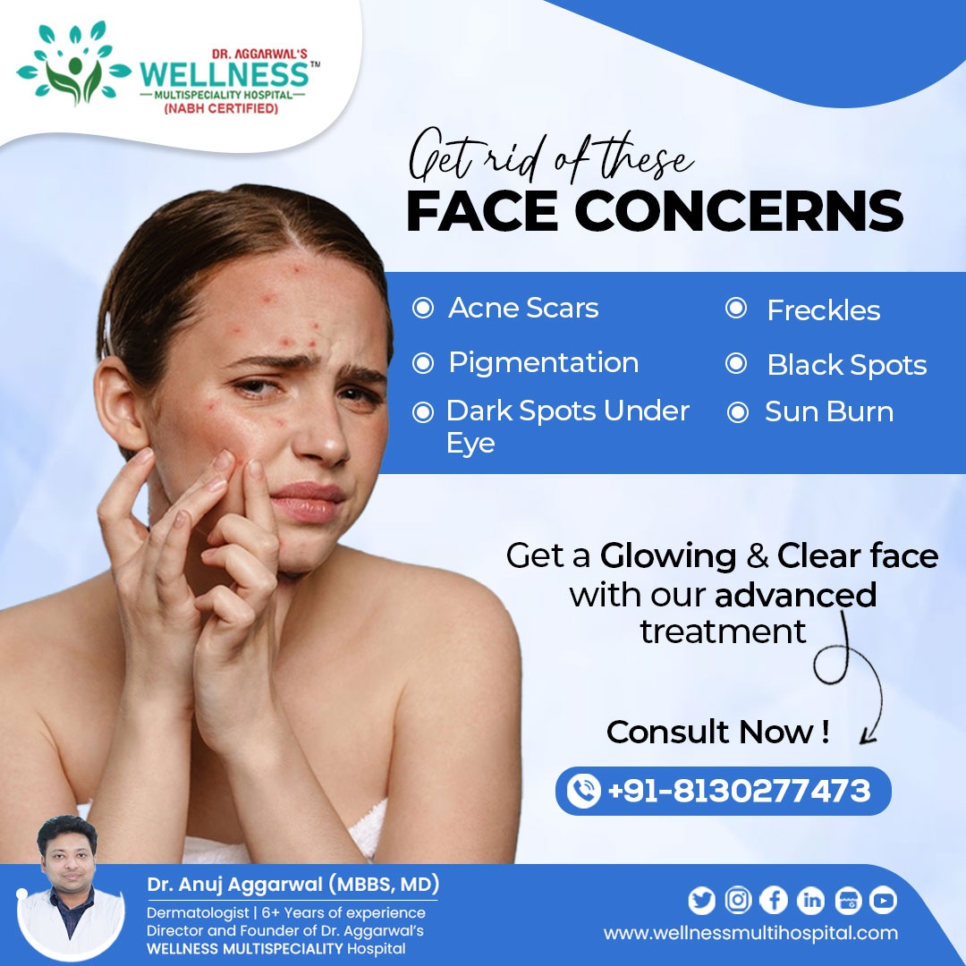 Eliminate These Facial Concerns:

👉 Freckles
👉 Black Spots
👉 Sunburn
👉 Dark Spots Under Eyes
And Achieve Glowing and Healthy Skin.'

Book an appointment@ wellnessmultihospital.com/book-an-appoin…

#wellnesshospital #dranujaggarwal #multispecialityhospital 
#SkinCareMagic #ExpertDermatology