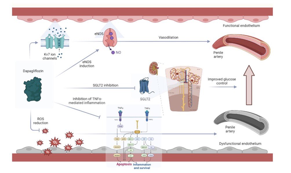 AntelmPujol's tweet photo. 🍆 La disfunción eréctil es la antesala al infarto. 

🤏🏻Las arterias que aportan irrigación al pene y permiten la ereccion son más pequeñas que las del corazón. 

🪢Por tanto, primero se podría obstruir las arterias del pene y posteriormente, la del corazón. 

⛑️La dapaglifozina (iSGLT-2) mejora la función eréctil en este nuevo estudio. 

🧬 No es de extrañar que cualquier intervención que mejore la salud arterial, mejorará la función sexual.

🫀 Reducir nuestro riesgo cardiovascular es proteger nuestra función sexual.