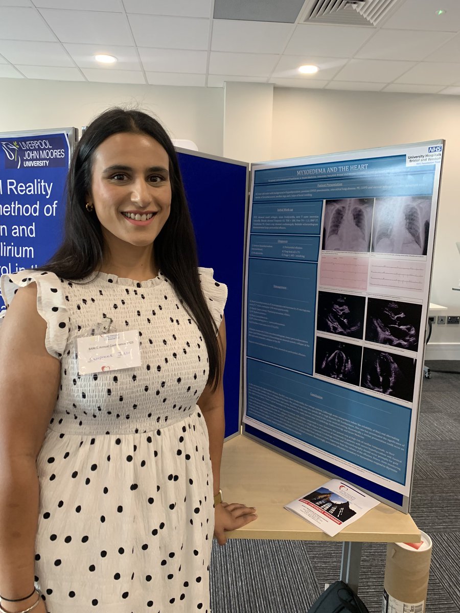 GJutla15's tweet photo. My first poster presentation today at @bancccouncil #BANCCconference on an AMU patient with myxoedema and large pericardial effusion. Thanks to @VOriolo for your help, support and mentoring! #advancedpractice @uhbwNHS https://t.co/X0IHdNcbC6