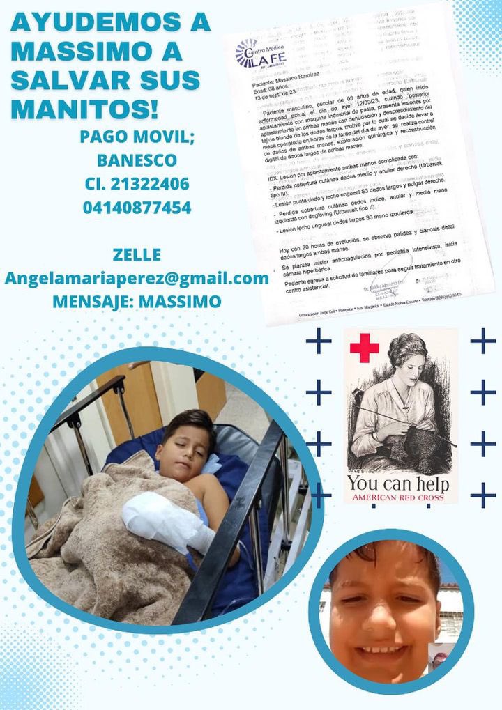 rcamachovzla's tweet photo. #ServicioPúblico Ayudemos a Massimo a salvar sus manitos. 🙏🏻🙏🏻🙏🏻 https://t.co/HYm6FTIz14