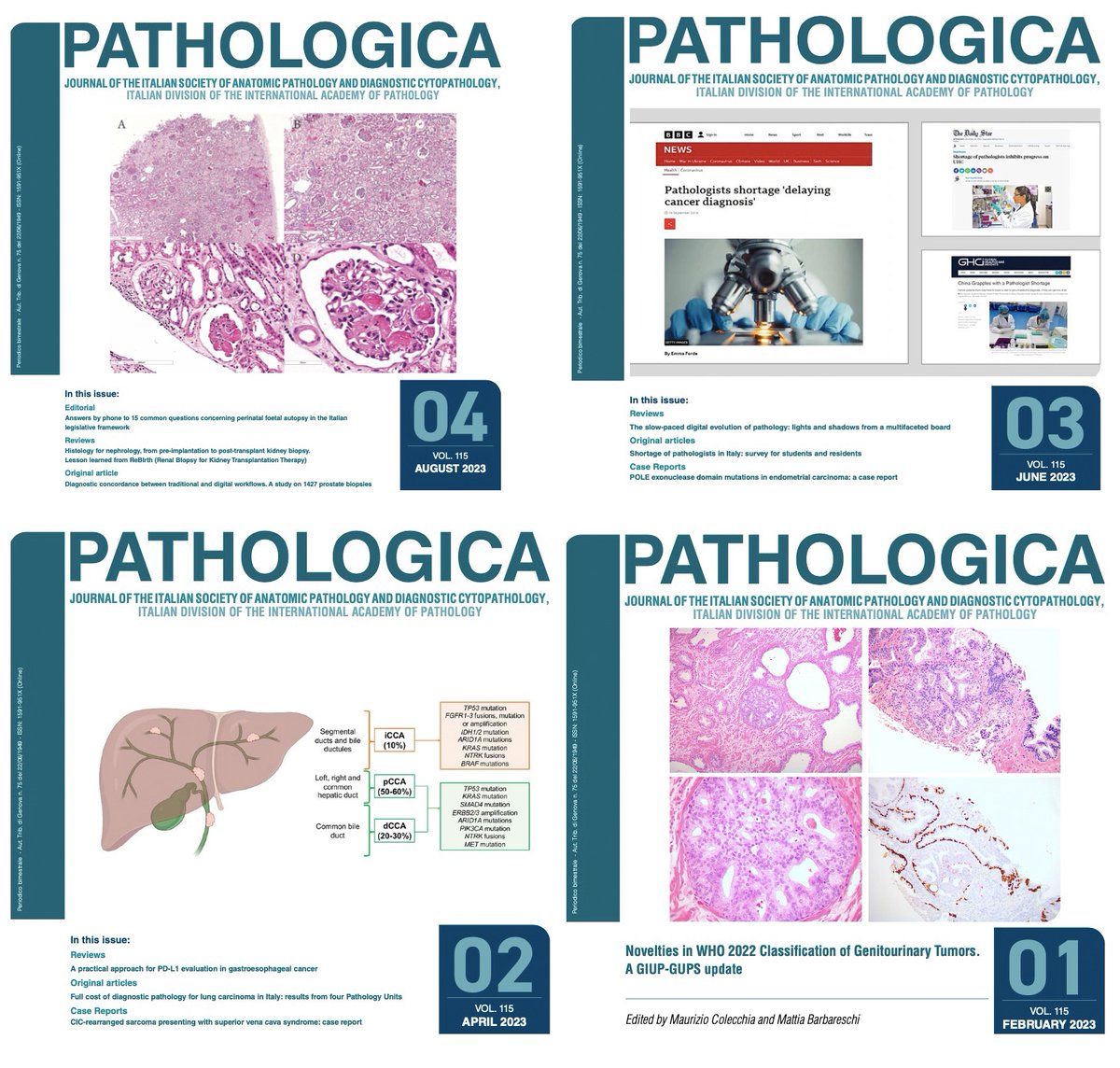 atman_ci's tweet photo. From #Molecular to #DigitalPath going through very useful reviews, nice case reports and #PathHistory. Pathologica, one of the oldest journals in #Pathology (1908), deservedly obtained a 3.5 Impact Factor. Please enjoy the free articles and publish on it: https://t.co/l7Ano0dFzl https://t.co/p9I2KGzDir