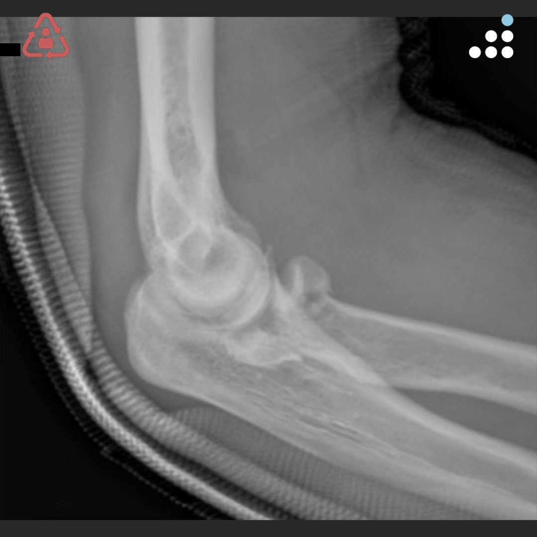 Orthobullets tweet media