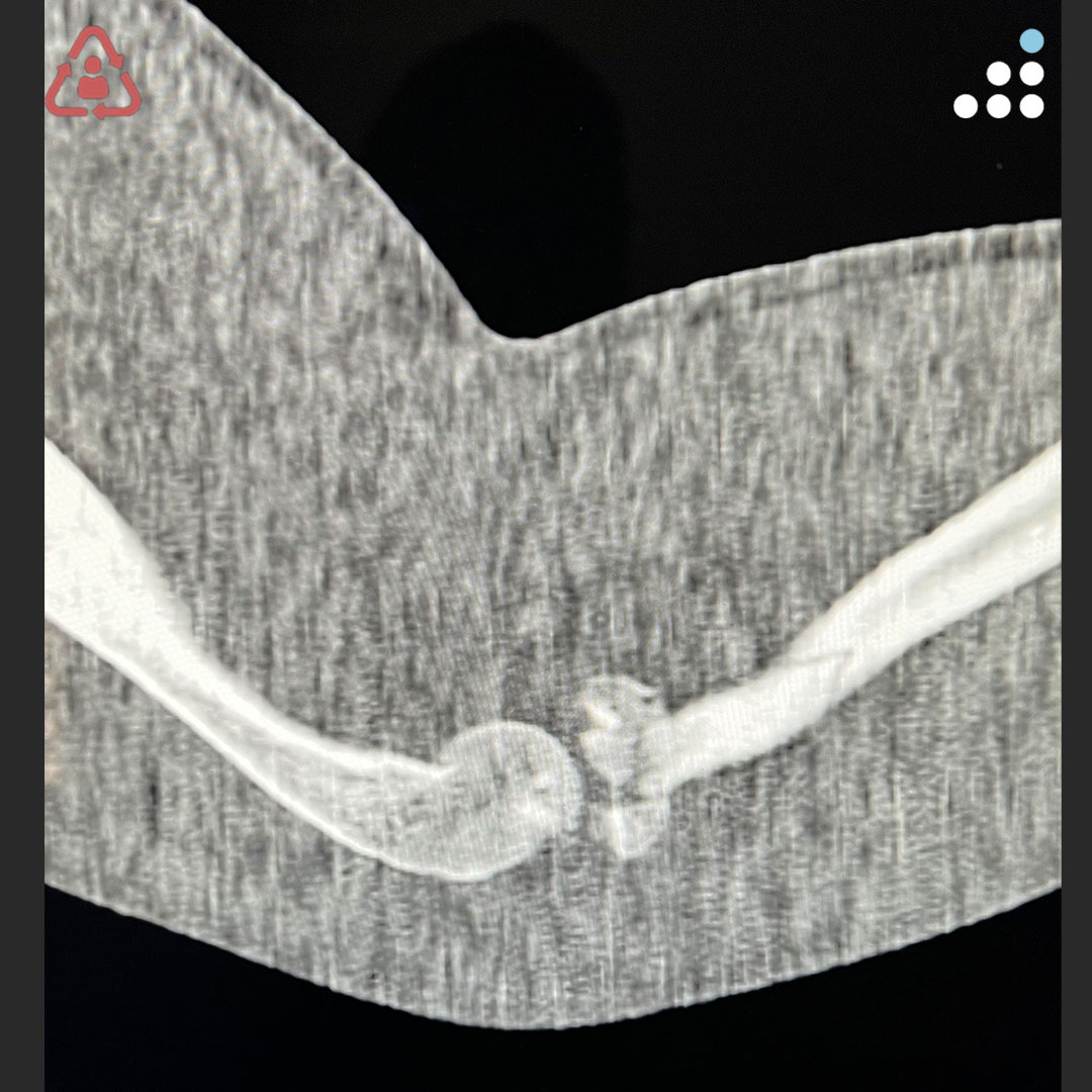 Orthobullets tweet media