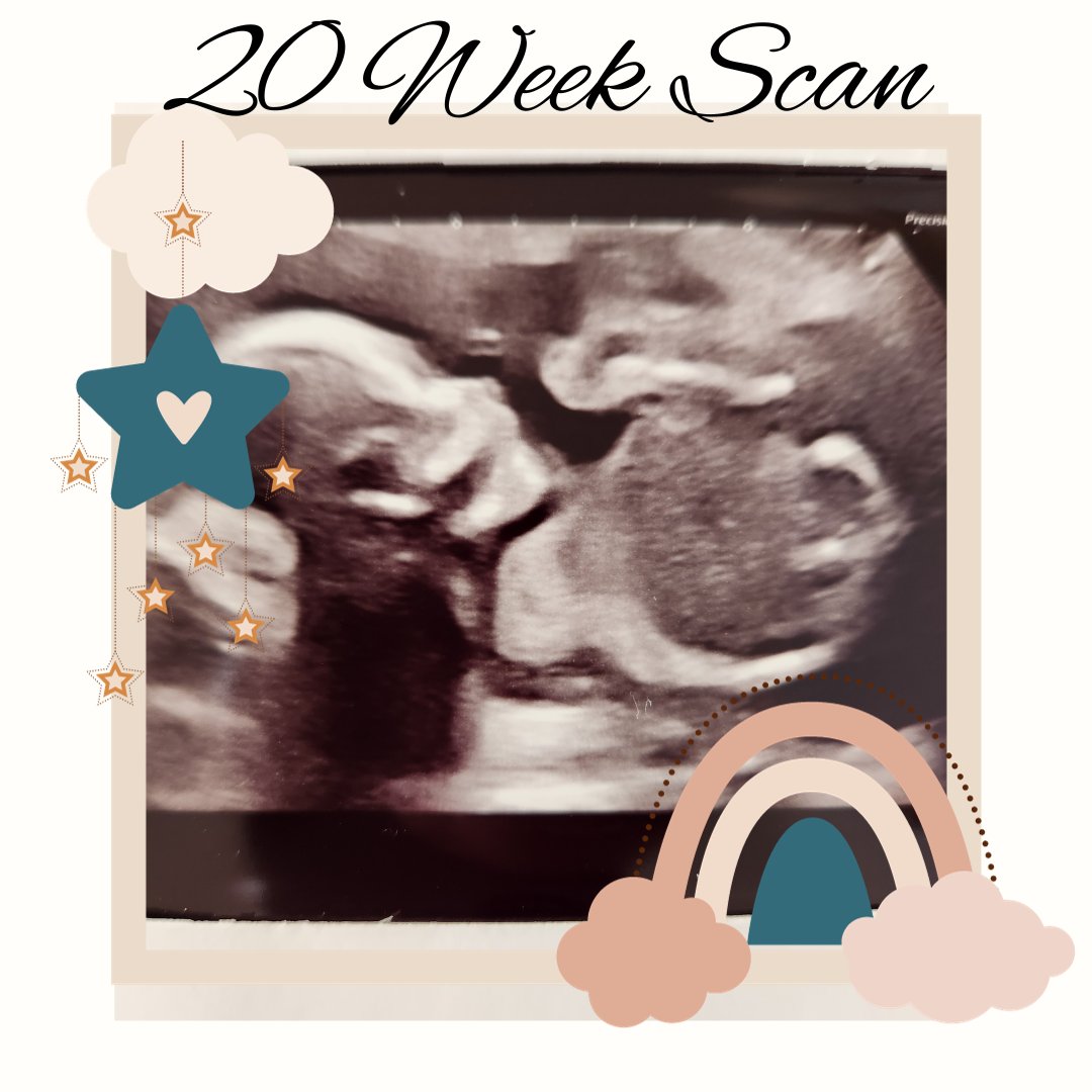hyggebooktours's tweet image. Back to reality now &amp;amp; I can't think of anything better to come home to ❤️

Half way there Little Cub 😍
That little nose and mouth though 🥰

#20weekscan #20weekspregnant