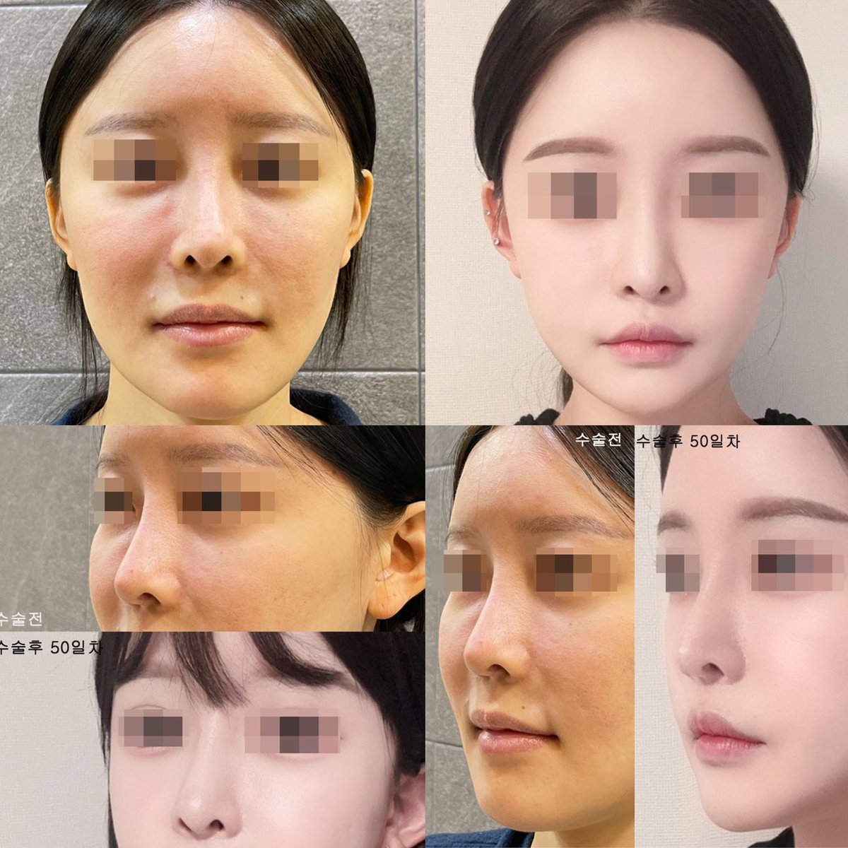 wan_hello_'s tweet photo. 頬骨と人中でここまで変わるのヤバくない？
ずるいぐらい可愛くなってる。 https://t.co/G8DdTJLGe2
