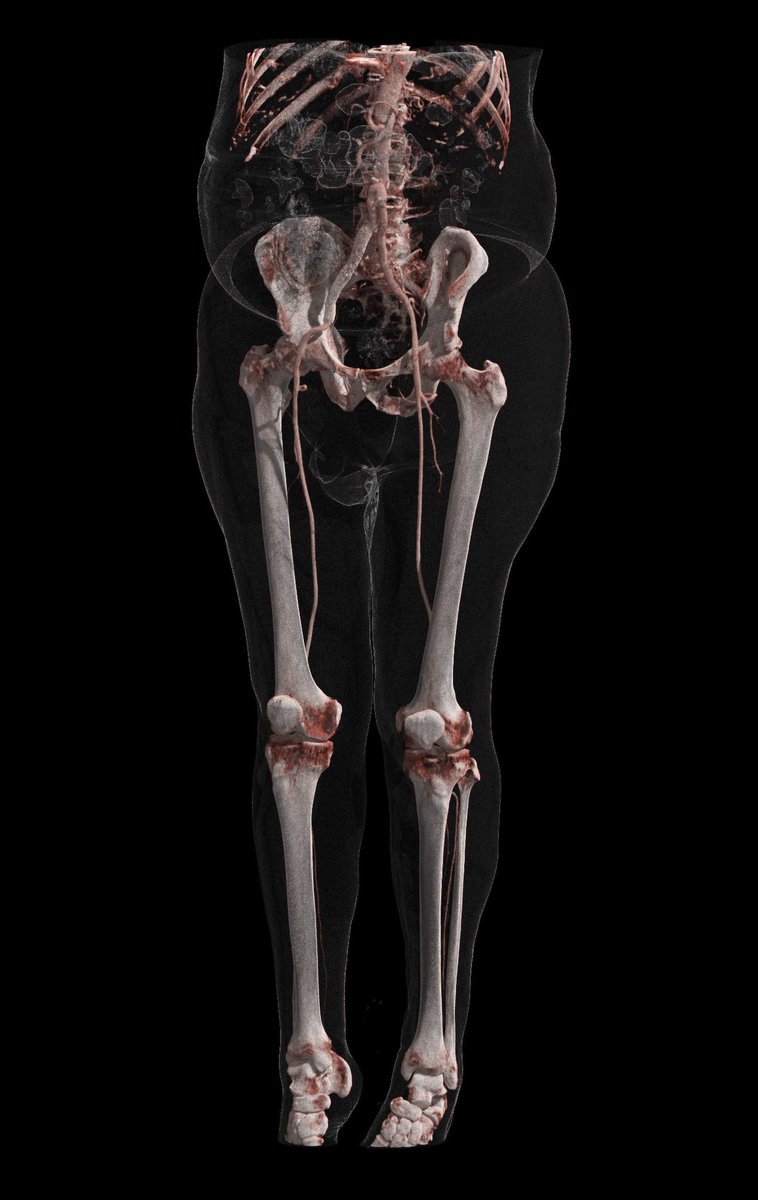 Horos Mobile™ tweet media