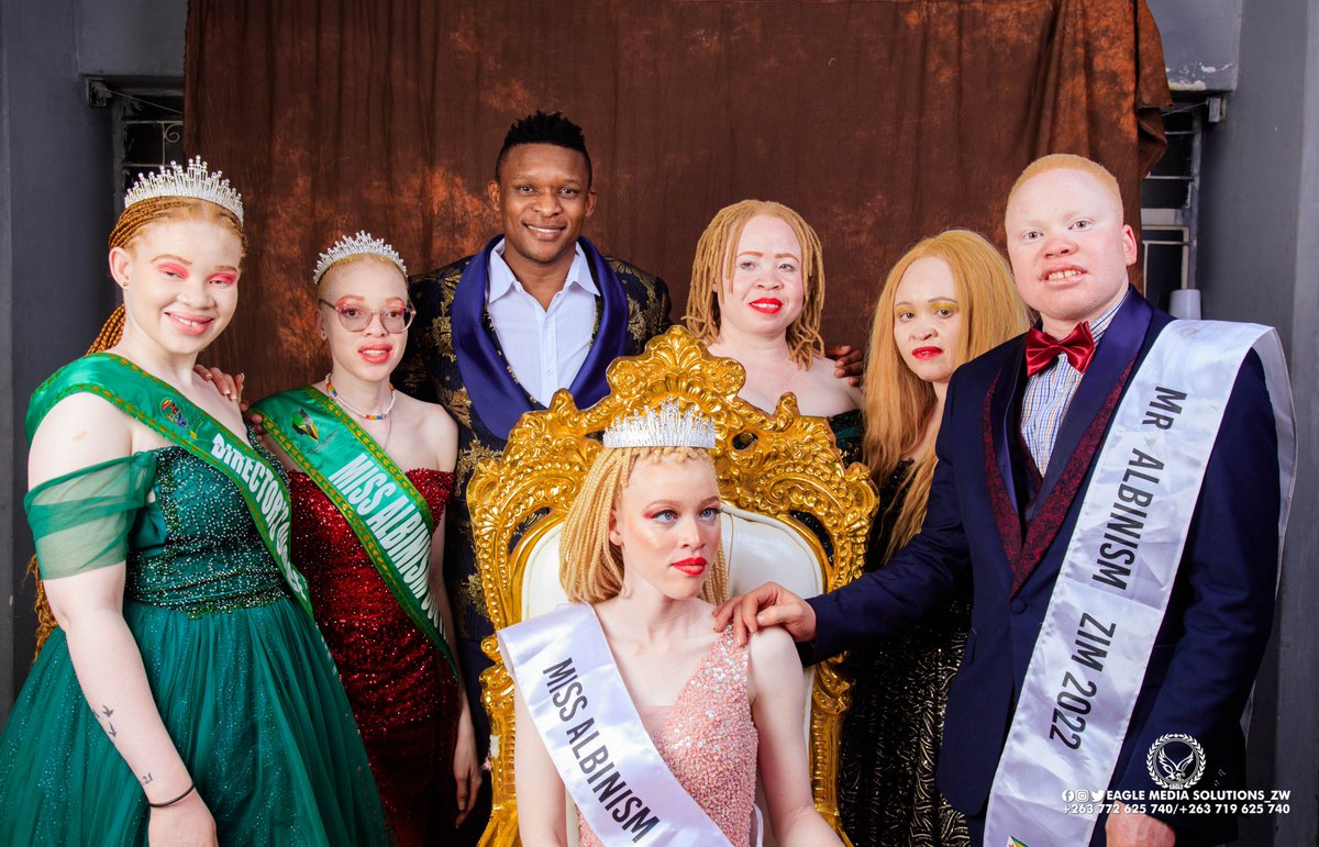 Queening_Angie's tweet photo. Royalty 👑 14 October its going down at HICC, lm the sole Zimbabwean Queen with Albinism on the pageant. Daughter of the soil, proudly from Cowdray Park Eskotshweni. #IFF
#AlbinismKonect
#IamAlbino
#WeAreOne
#Inclusion4equality https://t.co/NlyaIEC5HF