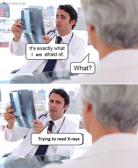 Me trying to read an x-ray before the radiology report comes back