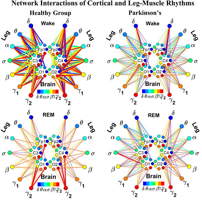 Plamen Ch. Ivanov (@plamenchivanov) on Twitter photo #NetworkPhysiology study in <a href="/FrontNetPhysiol/">Frontiers - Network Physiology</a> reveals dynamic #networks of interactions between #brain waves and rhythms in #muscle activity during #sleep, leading to novel network-based markers for early diagnosis of #Parkinsons.
fro.ntiers.in/S6wC #NetworkPhysiology study in <a href="/FrontNetPhysiol/">Frontiers - Network Physiology</a> reveals dynamic #networks of interactions between #brain waves and rhythms in #muscle activity during #sleep, leading to novel network-based markers for early diagnosis of #Parkinsons.
fro.ntiers.in/S6wC