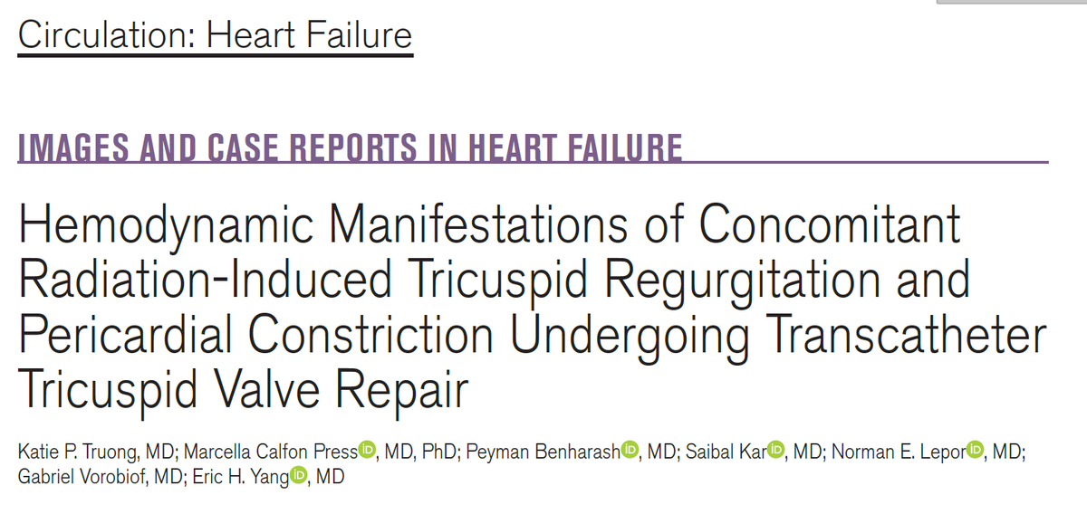 With the rise in tricuspid #TEER, what is its efficacy in #cardioonc--w/ ☢️valvulopathy + additional ❤️ sequelae? @uwashfellows @katieptr (@UCLAHealth IM res) brings this fascinating & challenging case managed by @UCLA_IC @MCalfonPressMD to @CircHF 1/ ahajournals.org/doi/abs/10.116…