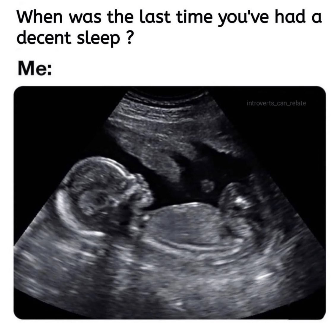 F6GjuCMWgAAq0Uw?format=jpg&name=medium