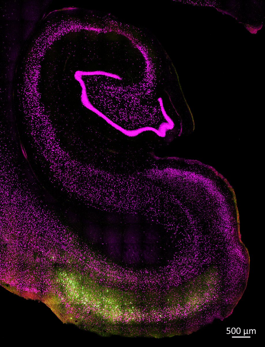 Why does #Alzheimer start where it starts?  What's your opinion about it? #FluorescenceFriday is the day for my unanswered questions that don't let me sleep at night 😅. The image below shows early misfolded tau (🟡tau ps422) and neurons (🟣neun) in our AD monkey model.