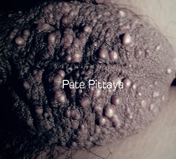 Pete Pittaya tweet media