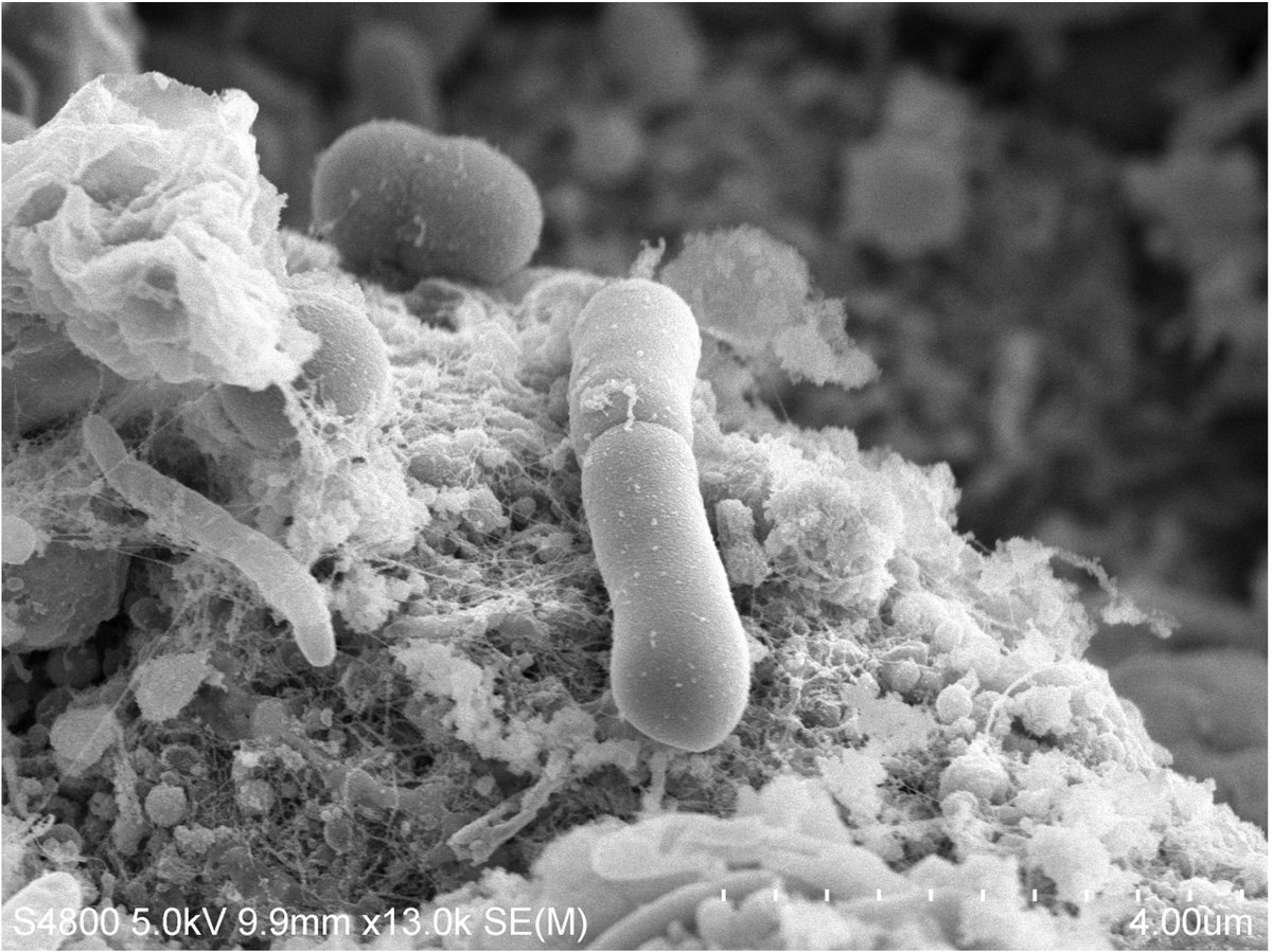 Jess Buddle (@buddlejess) on Twitter photo Super excited to share our preprint (which is also my FIRST research paper (!!!)) on vancomycin resistance in C. difficile using evolution – looking at fitness of evolved strains, mutations involved and population dynamics – A THREAD 🧵 (1/9)
biorxiv.org/cgi/content/sh… Super excited to share our preprint (which is also my FIRST research paper (!!!)) on vancomycin resistance in C. difficile using evolution – looking at fitness of evolved strains, mutations involved and population dynamics – A THREAD 🧵 (1/9)
biorxiv.org/cgi/content/sh…