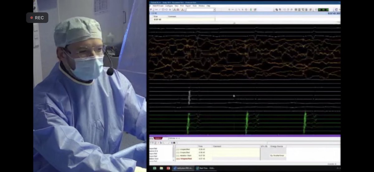 @dvidschaack on 🔥!!! #RFballoon LSPV live isolation in 9 seconds!!! @AcademyFafa