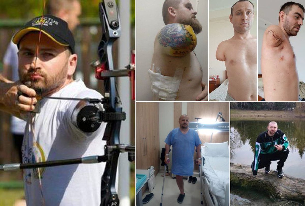 A unique chance for wounded Defenders to return to a full life

 The Center for Complex Endoprosthetics, Osseointegration and Bionics, together with the famous Swedish professor Rikard Brånemark, will perform six unique osseointegration operations for wounded military personnel.…