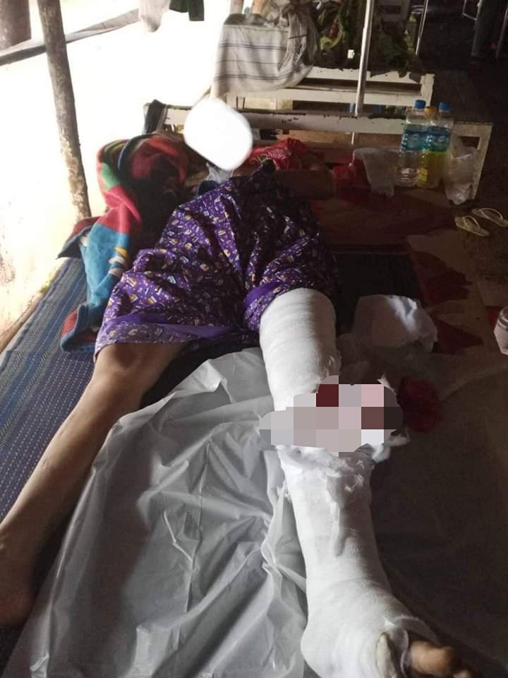 Chan45704011's tweet photo. Mon State, It is known that 1 child and 1 woman were injured and 3 homes were damaged due to the terrorist army firing heavy weapons at villages in Thaton Township.

#2023Sep16Coup
#NoMoreDirtyDeals
#DoMoreSingapore 
#WarCrimesOfJunta
#WhatsHappeningInMyanmar https://t.co/kpjmrbmYgP