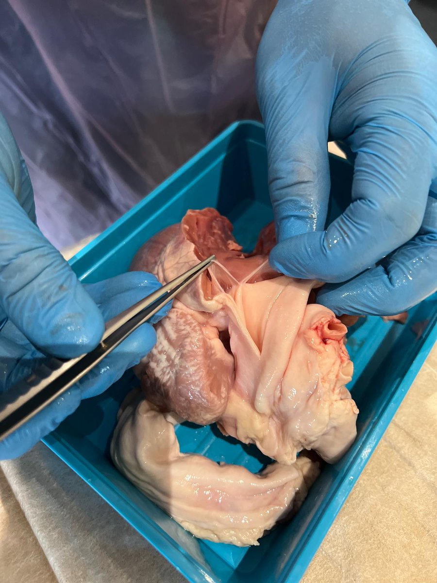 Great day <a href="/bancccouncil/">BANCC💙</a> conference yesterday. Presentations and updates in morning session, followed by hands on sessions in the afternoon. Echo and angio, and anatomy performing dissection on pig hearts