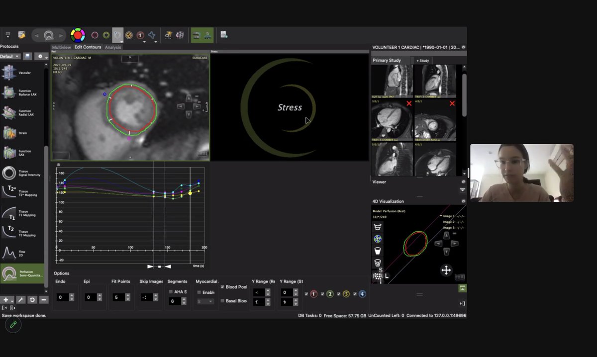 👩‍💻Live now at Scan With Me (SWiM)... ...Dr. Katerina Eyre (PhDC @mcgillu) is at @euracare_ng Lagos, Nigeria and shows us step-by-step how to analyse BMORE CMR acquisitions using @circlecvi cvi42. 🙏 Thank you ACCUREAD Radiology & @irdocnigeria @mcgillGPS_FMHS #SWiM #BMORE