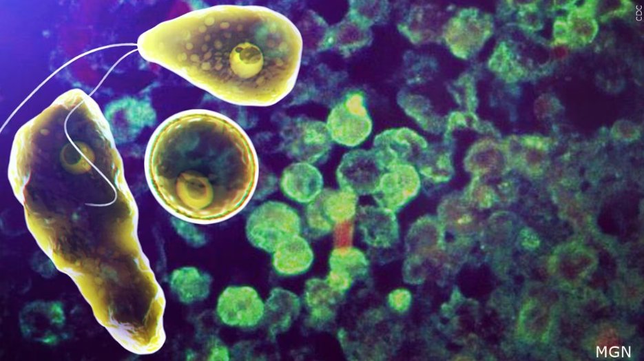 1 person dies after being exposed to brain-eating amoeba at country club, health officials say: tinyurl.com/ynam8ac4