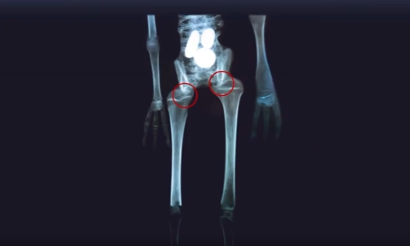 ElBadiablo's tweet photo. La maravillosa anatomía de un Alien:
1-Sus húmeros son fémures.
2-Un fémur está al revés y el otro es una tibia.
3-Son de diferente tamaño y carece de articulación.
4-Las falanges apuntan en diferentes direcciones. 
La evolución en otros planetas es simplemente magnífica. https://t.co/GovxmVseDw
