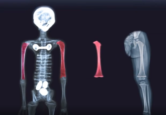 ElBadiablo's tweet photo. La maravillosa anatomía de un Alien:
1-Sus húmeros son fémures.
2-Un fémur está al revés y el otro es una tibia.
3-Son de diferente tamaño y carece de articulación.
4-Las falanges apuntan en diferentes direcciones. 
La evolución en otros planetas es simplemente magnífica. https://t.co/GovxmVseDw