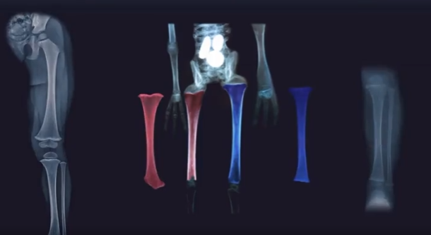 ElBadiablo's tweet photo. La maravillosa anatomía de un Alien:
1-Sus húmeros son fémures.
2-Un fémur está al revés y el otro es una tibia.
3-Son de diferente tamaño y carece de articulación.
4-Las falanges apuntan en diferentes direcciones. 
La evolución en otros planetas es simplemente magnífica. https://t.co/GovxmVseDw