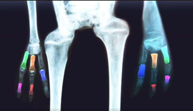 ElBadiablo's tweet photo. La maravillosa anatomía de un Alien:
1-Sus húmeros son fémures.
2-Un fémur está al revés y el otro es una tibia.
3-Son de diferente tamaño y carece de articulación.
4-Las falanges apuntan en diferentes direcciones. 
La evolución en otros planetas es simplemente magnífica. https://t.co/GovxmVseDw