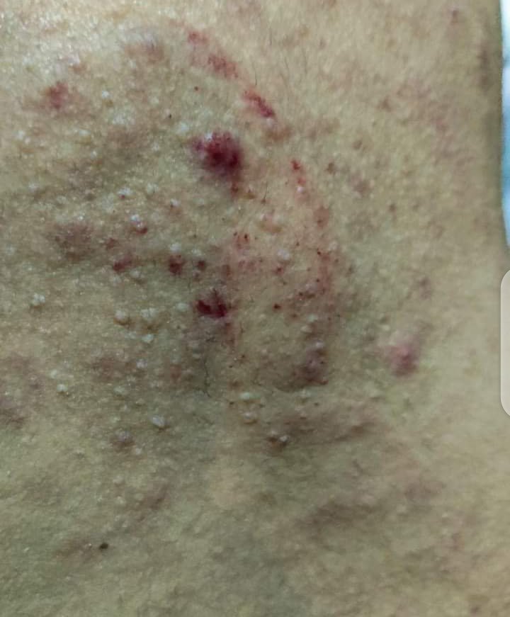 ZK_Lawyer's tweet photo. Students had to face violence at the hands of the Punjab University administration because they were protesting against the recent fee hike by 100%. We condemn the fascist policies of PU and demand that those involved must be held responsible.
#NoVCinPU
#ResolvepuStudentsIssues https://t.co/hxGi7fZPLl