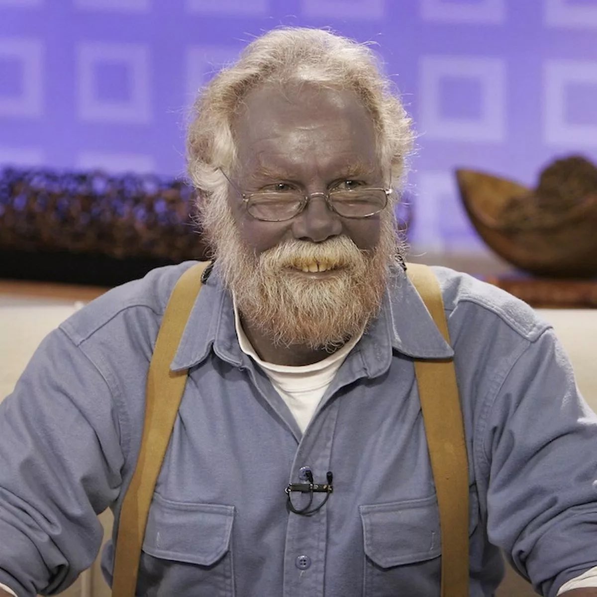 Blue man Paul Karason is still blue after he self-medicates with