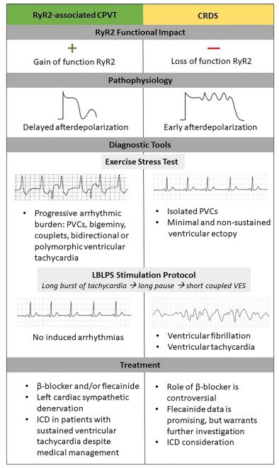 Check out our review on Calcium Release Deficiency Syndrome (#CRDS). We explored the molecular and clinical aspects of CRDS, and compared it to #CPVT. To date, 33 patient-specific loss of function RyR2 variants are reported. See here: cardiacep.theclinics.com/article/S1877-…