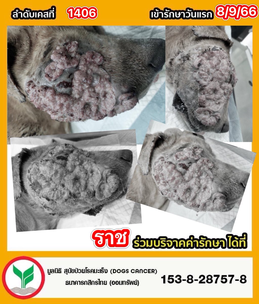 DogsCancer's tweet photo. #ระดมทุนมะเร็งที่ตาแตกมีก้อนเนื้อเน่า!!
🔺ราช ลำดับที่ 1406 เข้ารักษา 08/09/66
 เพศ ผู้ น้ำหนัก 21 kg. 
#อัพเดตอาการวันที่ 17-09-66 คุณหมอได้แจ้งว่าหลังจากได้ทำหรือคีโมไปแล้ว1เข็ม ยังไม่มีการเปลี่ยนแปลงให้เห็นอย่างชัดเจน คุณหมอจึงจะทำการตัดชิ้นเนื้อเพื่อส่งแลปไปตรวจว่าเป็นมะเร็งชนิดไหนให้ชัดเจนมากยิ่งขึ้น เพื่อได้หายาคีโมที่สามารถรักษาราชได้และในกรณีที่ไม่มียาคีโมจริงๆอาจจะต้องมีการผ่าตัดก้อนเนื้อในอนาคต  น้องยังมีอาการดุ กัดหวาดระแวงจึงทำการรักษาได้ค่อนข้าง
ยาก
#ผลเลือด 
-ค่าตับ ปกติ
-ค่าไต ปกติ
-เกล็ดเลือดดีขึ้นจากที่มาตอนแรก
🔻เข้ารักษาด้วยอาการตาแตกและมีก้อนเนื้อเน่าที่ใบหน้า ส่งกลิ่นเหม็น ร่างกายซูบผอม ใบหน้าเต็มไปด้วยน้ำเลือด น้ำหนอง ก้อนมีขนาดค่อนข้างใหญ่ลามไปถึงกราม เบื้องต้นในการตรวจต้องใช้วิธีวางยาสลบเพื่อตรวจ เพราะราชมีอาการระแวง ขี้กลัว ก้อนเนื้อที่ใบหน้าคุณหมอวินิจฉัยแล้วว่าเป็นมะเร็งชนิดที่รักษาให้หายได้ยาก คุณหมอล้างทำความสะอาดก้อนฉีดยาฆ่าเชื้อ ทำวัคซีนกันเชื้อที่อันตรายต่อร่างกายป้องกันไว้ และได้เริ่มให้คีโมเข็มแรก หลังจากนี้ต้องคิดตามอาการและดูแลอย่างใกล้ชิด 
#ผลเลือด
-มีภาวะเลือดจางมากและเป็นพยาธิเม็ดเลือดร่วมด้วย
-มีค่าน้ำตาลที่สูงกว่าปกติจึงจะมีผลทำให้
การรักษาหรือสมานแผลจะช้ากว่าสุนัข
ที่มีค่าน้ำตาลปกติ
-ผลตรวจไข้หัด : ไม่เป็น
-ผลตรวจลำไส้ : ไม่เป็น

#ร่วมบริจาคช่วยสุนัขป่วยโรคมะเร็ง
📌มูลนิธิ สุนัขป่วยโรคมะเร็ง(Dogs 
Cancer) 
 ธนาคาร  : กสิกรไทย 
เลขบัญชี  : 153-828757-8

📌มูลนิธิ เลขที่ 5/2566

📞 ติดต่อมูลนิธิฯ 
โทร : 064-2463664

🔹-Line id : @dogscancer
https://t.co/vZhyIvvKyd 

🔹-Instagram : dogscancerfoundation 

🔹-ติดต่อเพจฯ Inbox 👇
https://t.co/xUqppbWORg. 

🔹-หรือสำหรับเยี่ยมชมเพจฯ👇
https://t.co/5bhEYjAgPs. 

ปัจจุบันทางเพจมีเคสที่รับผิดชอบและรักษาอยู่จำนวนมากเกือบ 142 ชีวิต หากมียอดบริจาคที่เกินในแต่ละเคส เราจะนำช่วยเหลือช่วยเหลือค่ารักษาในเคสต่อไป