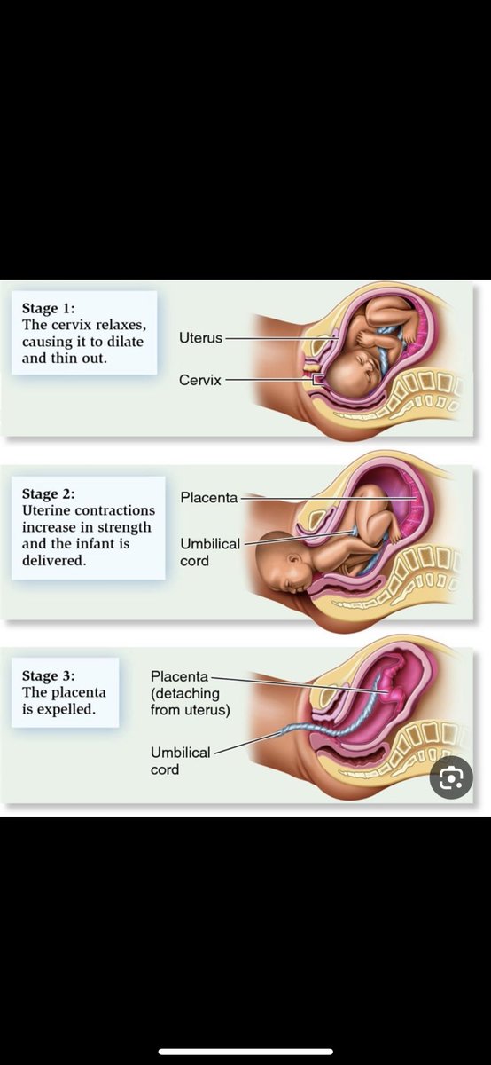 Stages of delivery