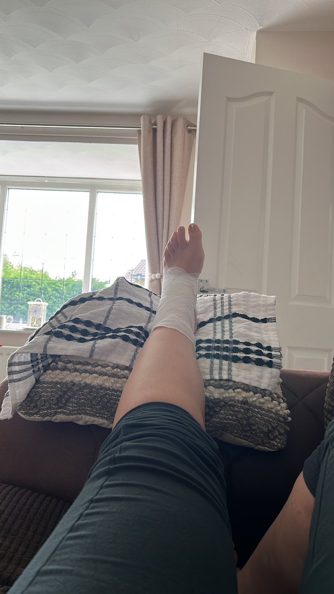 jenken88's tweet image. For anyone who wants to argue dancing isn’t a sport….. ballroom damages tendons! Im on protest and refuse to do a foxtrot anymore. At least strictly is back whilst I’m stuck with my feet up 🤦🏻‍♀️#danceinjury #competitionprep