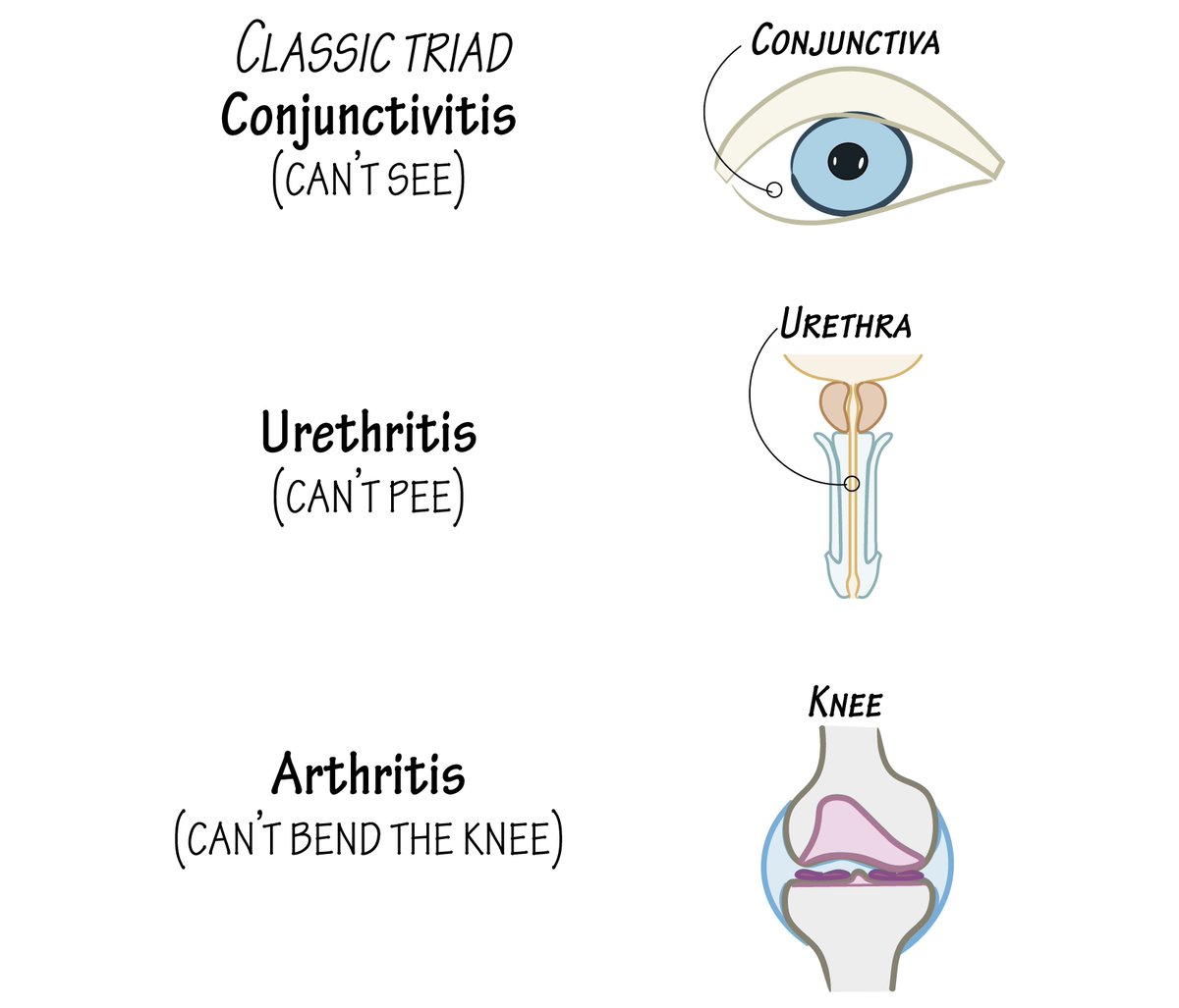 Which condition is described by this classic triad?