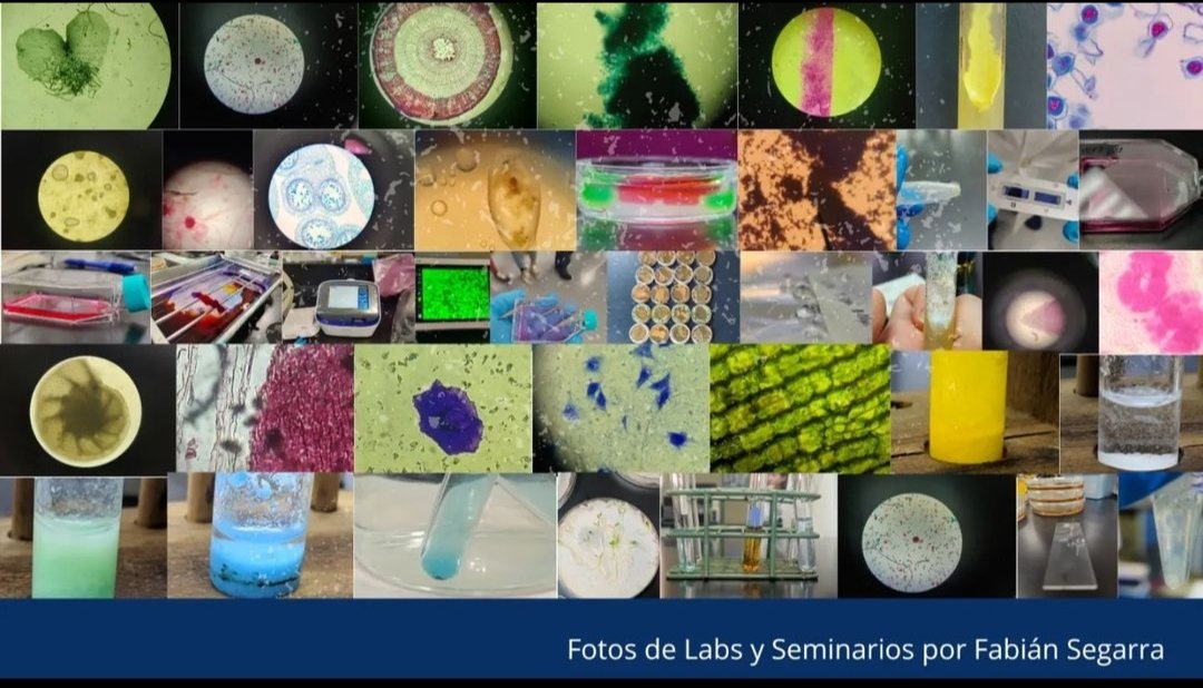 SegaBioTech's tweet image. Happy Microbiology Day! 🧬🧫🦠

"Microbiology teaches us that size is no measure of significance; even the smallest microbe can wield immense power..."

-Aloo Denish