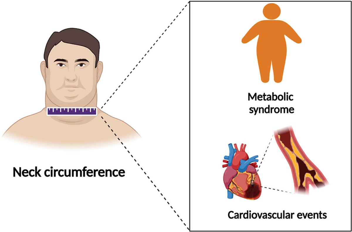 ATHjournal's tweet photo. Neck Circumference is closely associated with MetS and its components, coronary calcification and lesion degree, and MACEs
🔗https://t.co/D1agl7YuAq
@society_eas #CardioTwitter https://t.co/hfb79MElED