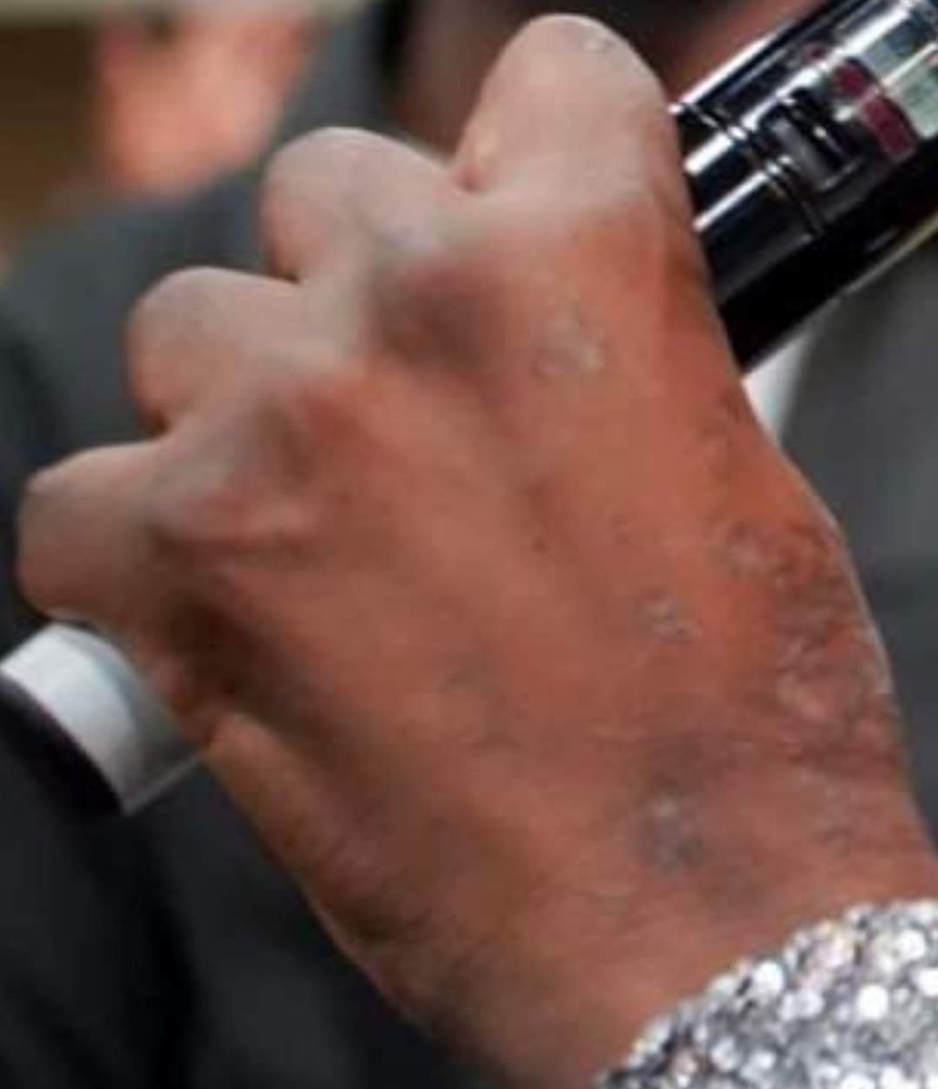 ZimEye's tweet photo. Passion Java's Mysterious Hand Deterioration: A Cause for Concern https://t.co/7fFbB4xgeZ https://t.co/AP3G3aEWpD