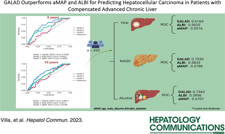 A win for GALAD in @HepCommJournal This liver cancer biomarker includes: Gender, age, AFP-L3, AFP, des-gamma-carboxy prothrombin It discriminates risk of HCC in people with #cirrhosis from metabolic liver disease Are you using it? From: Dr. Erica Villa journals.lww.com/hepcomm/fullte…