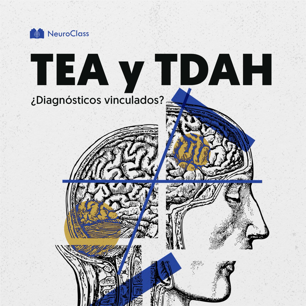 TEA y TDAH: Desafíos para su diagnóstico🧐 🧵En este hilo te contaremos acerca de las similitudes del Trastorno del Espectro Autista y el Trastorno por Déficit de Atención e Hiperactividad que generan dificultades al momento de su diagnóstico