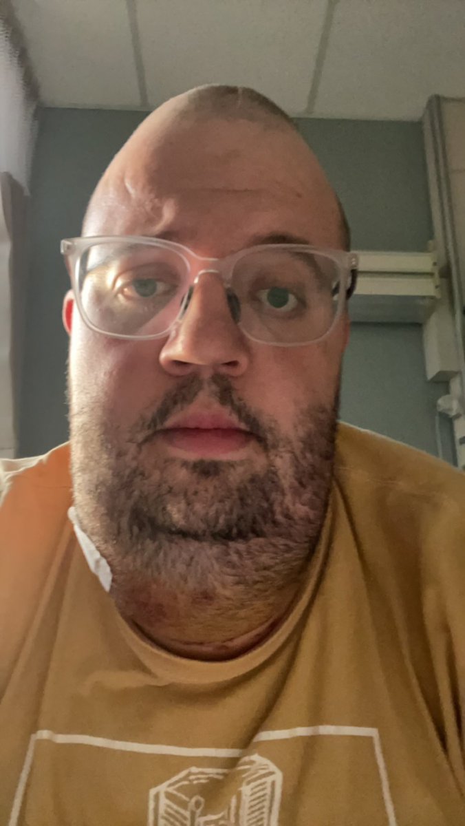 Sleezysheets's tweet photo. Fn cancer got me lookin like bubble bass . #thyroidcancer #Cancer2023 #gottalaugh https://t.co/DYSFaeKSXs