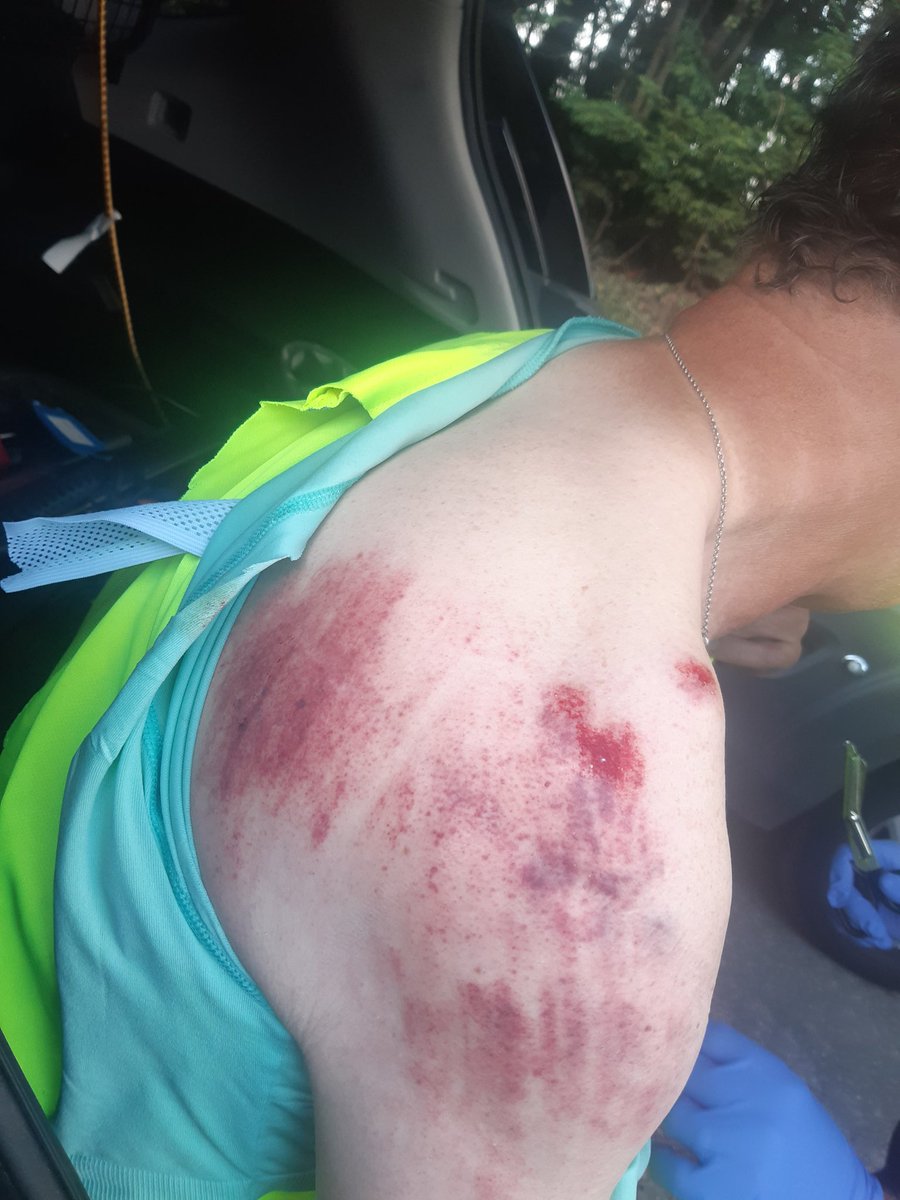 G_0_PEK's tweet photo. Bike helmet saved me from serious injury. Walked away from a 30mph crash on Boxley hill. The bike got mangled under a car. https://t.co/NVHfEC5Wlb