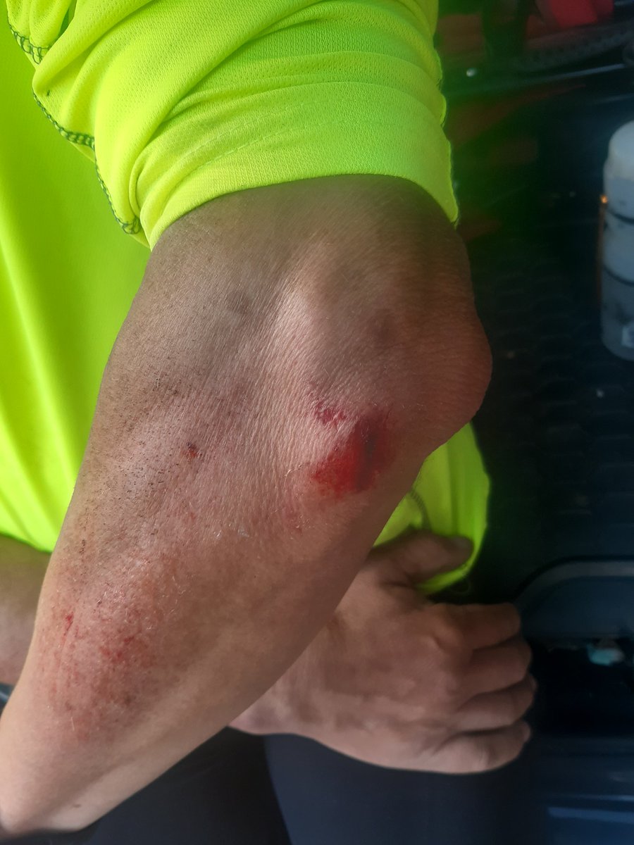 G_0_PEK's tweet photo. Bike helmet saved me from serious injury. Walked away from a 30mph crash on Boxley hill. The bike got mangled under a car. https://t.co/NVHfEC5Wlb
