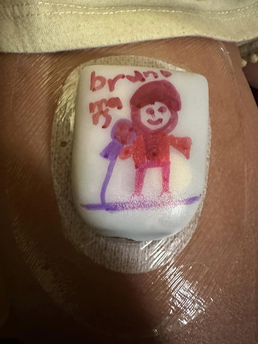 AshleyVarol's tweet photo. Eek! @BrunoMars - daughter (7yo Ayla!) and I can't wait to see you tonight! She even drew you on her Insulin Pump (my little Type 1 Diabetes Warrior is my hero!!) @BourbonandBeyond https://t.co/rOxk96HaUo