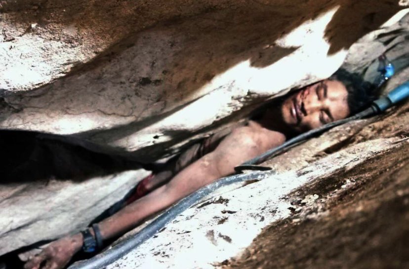 Poor Cambodian guy was trapped like this for four days after slipping while alone in the jungle. After finding him, it took ten hours of chipping away at the rock to free him. He survived and fully recovered.