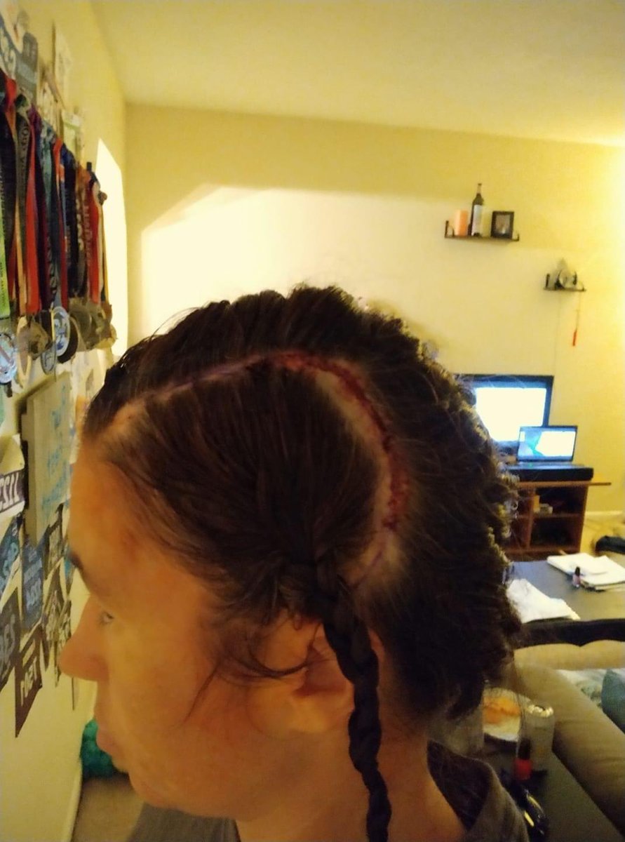 bashora33's tweet image. Two years ago vs today. Be a fighter!