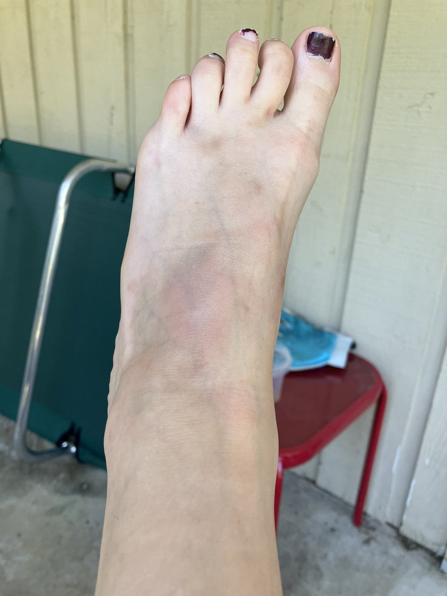 bashora33's tweet image. Two years ago vs today. Be a fighter!